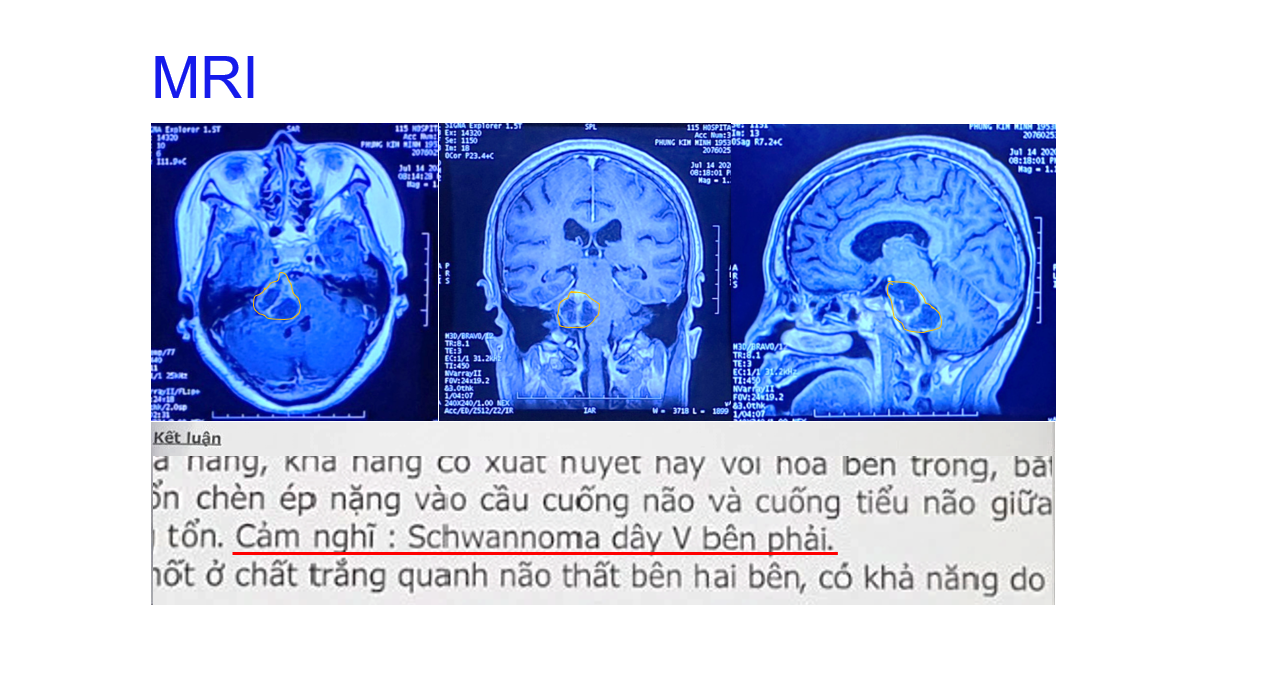 C U B Nh Nh N U N O Ti N L Ng X U B Ng Robot M N O Hi N I Modus V