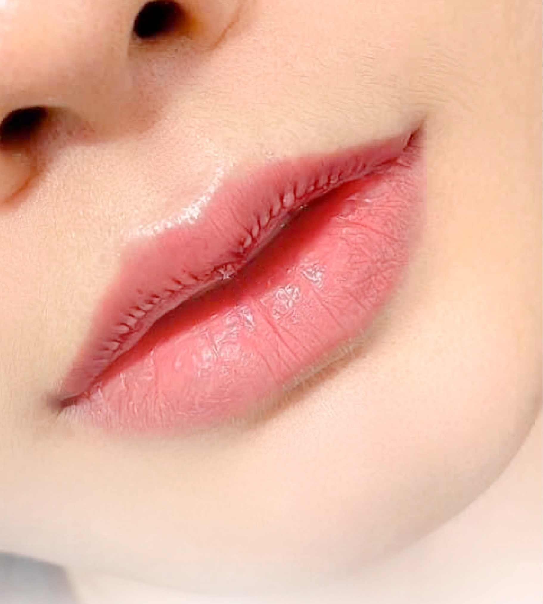 Review tạo khóe môi cười – Có nên làm không?