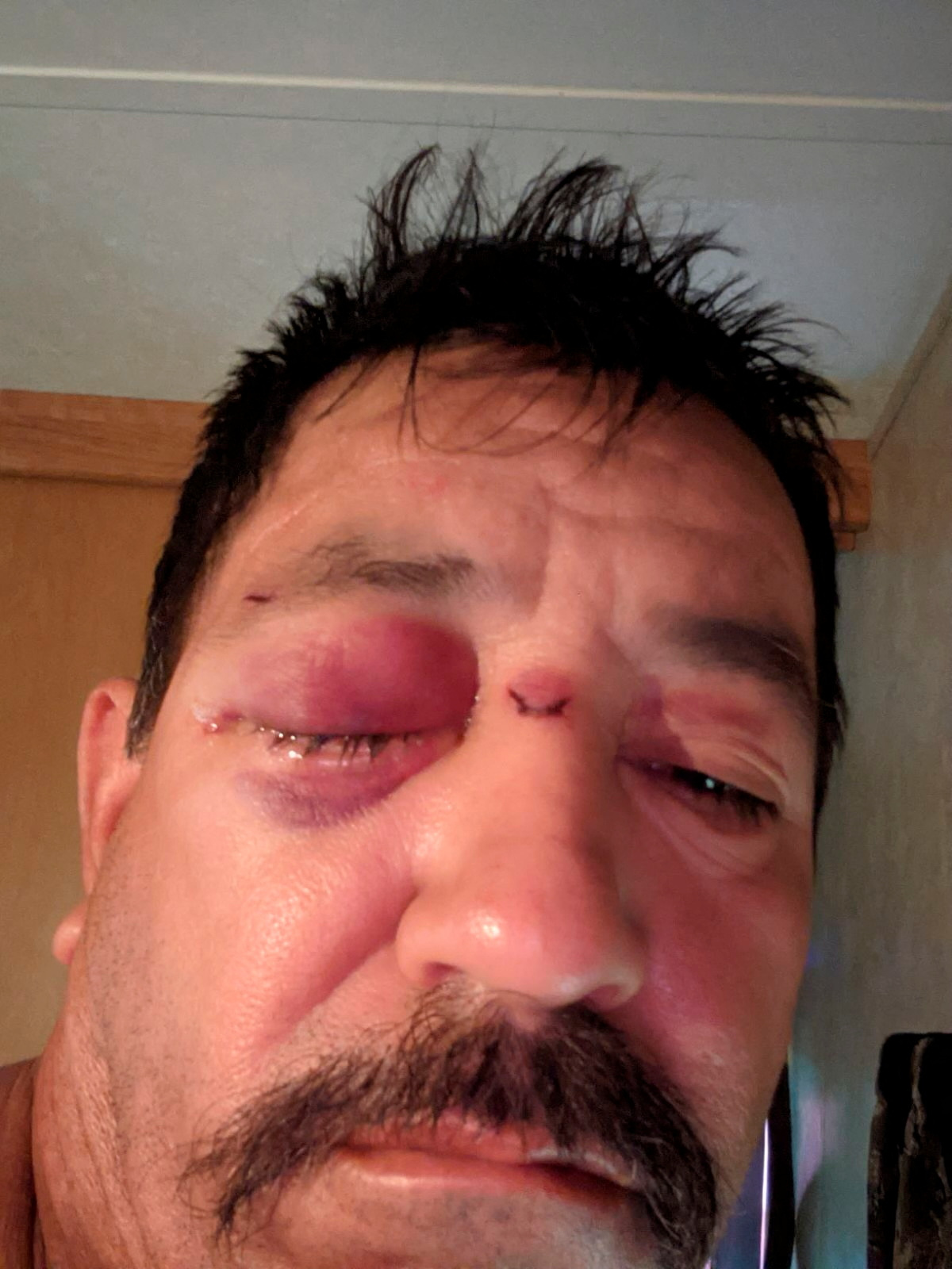 Nhiều cựu nh&acirc;n vi&ecirc;n tố SpaceX kh&ocirc;ng đảm bảo an to&agrave;n lao động - Ảnh 1.