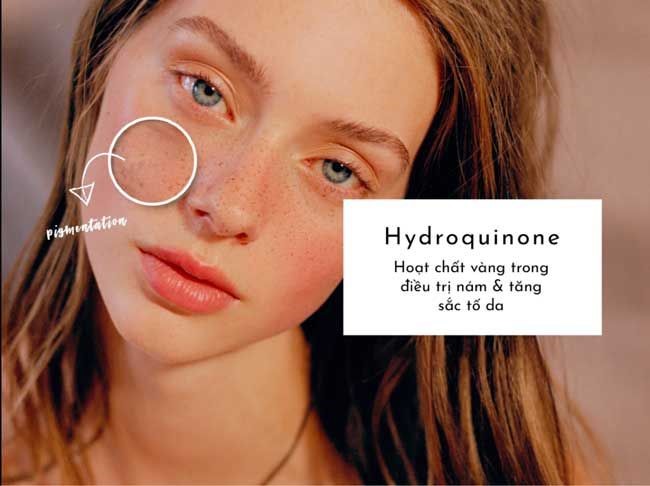 Top 5 sản phẩm chứa Hydroquinone trị nám, sáng da được chuyên gia da liễu tin dùng - Ảnh 1.
