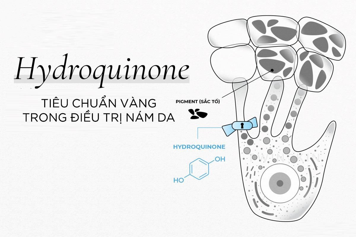 Top 5 sản phẩm chứa Hydroquinone trị nám, sáng da được chuyên gia da liễu tin dùng - Ảnh 2.
