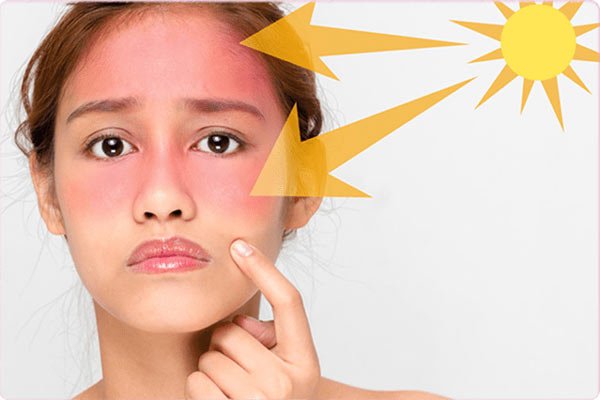 Top 10 kem chống nắng cho da treatment được các chuyên gia da liễu tin dùng - Ảnh 2.