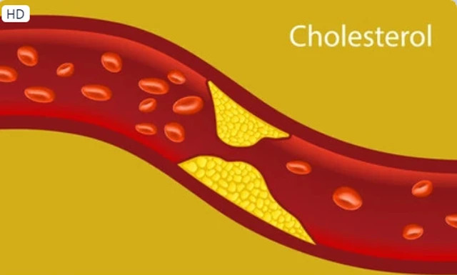Người có cholesterol cao nên ăn bao nhiêu trứng mỗi ngày? - Ảnh 2.
