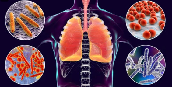 Viêm phổi tăng ở trẻ em nhiều nước: Các triệu chứng cần chú ý - Ảnh 2.