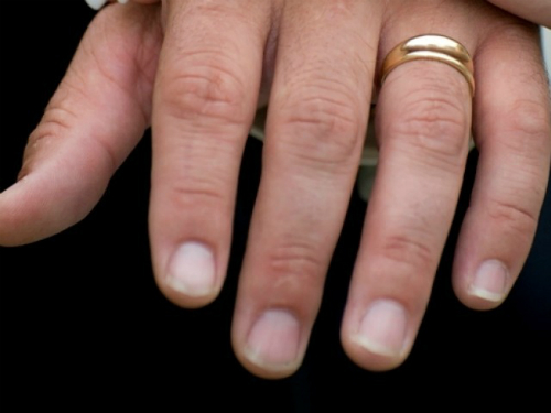 Cách thú vị đo ngón tay để biết bạn có nguy cơ bị hói hay không - Ảnh 2.