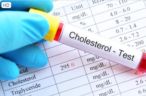 Loại trái cây là vũ khí giảm mức cholesterol cao hiệu quả hơn cả thuốc - Ảnh 1.