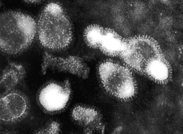 Campuchia phát hiện thêm 12 ca nhiễm H5N1 sau khi bé gái tử vong - Ảnh 1.