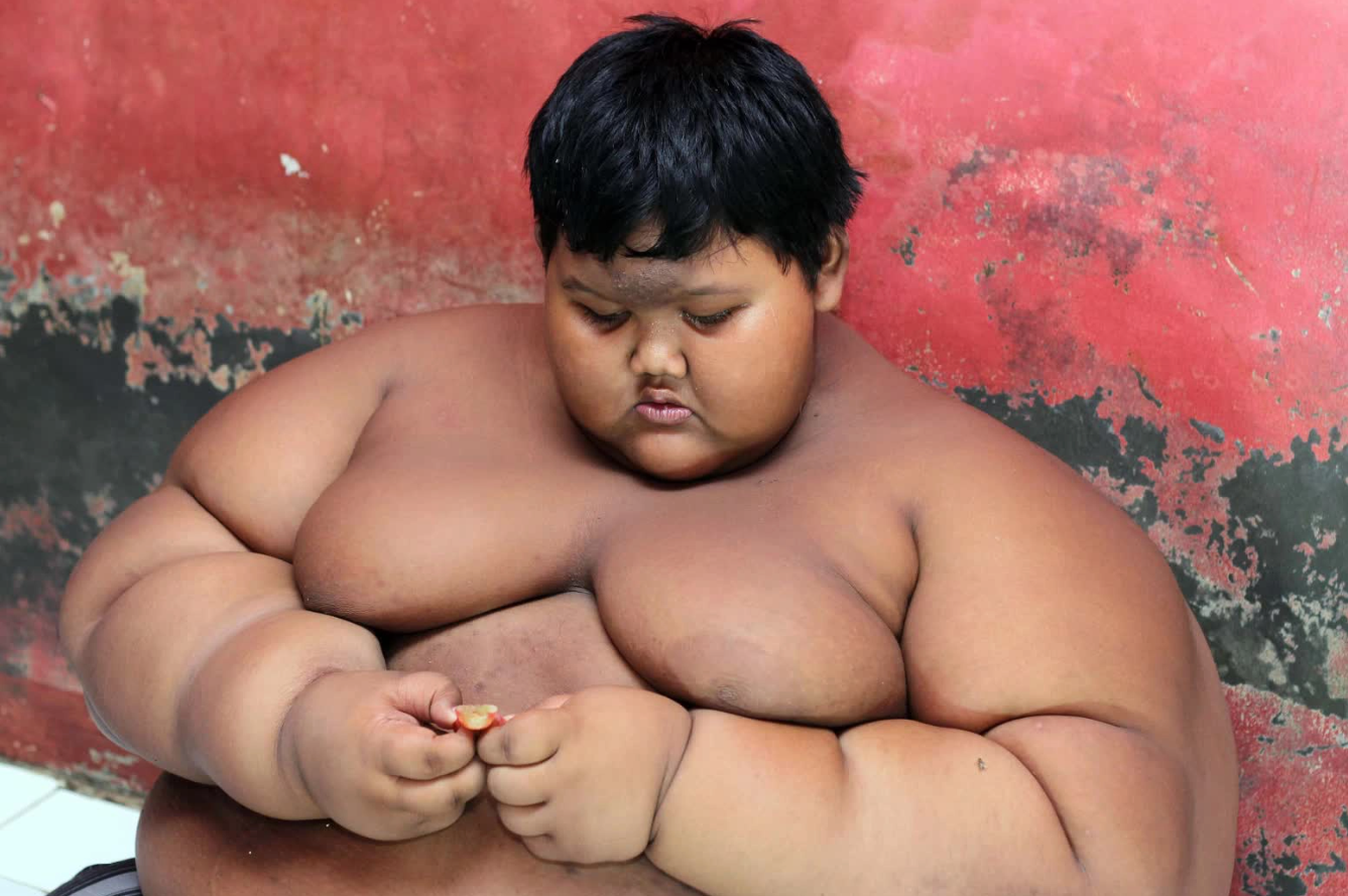 How is the 'fattest boy in the world' now?  - Photo 1.