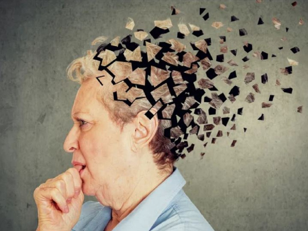 Alzheimer's disease brain hi-res stock photography and images - Alamy