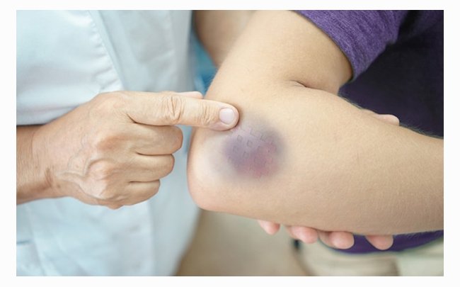 Những dấu hiệu ung thư sớm ở trẻ, cha mẹ nên biết