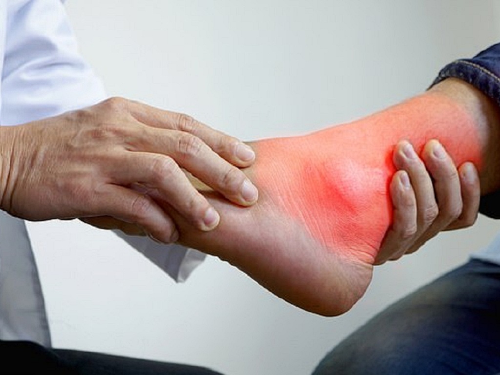 Bị gout, cần tập luyện thể thao thế nào?