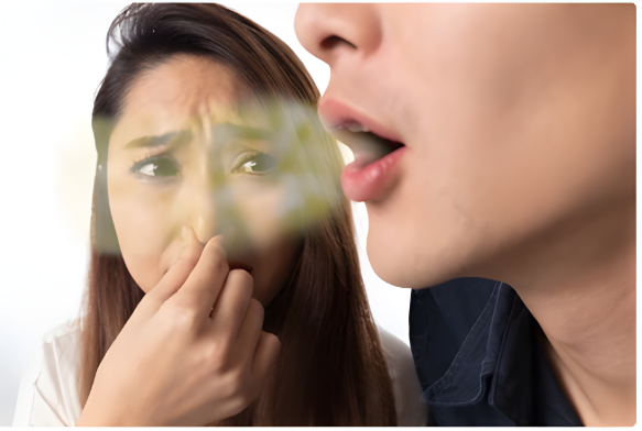 Bác sĩ giải thích lý do hơi thở có mùi ngay cả sau khi đánh răng - Ảnh 1.