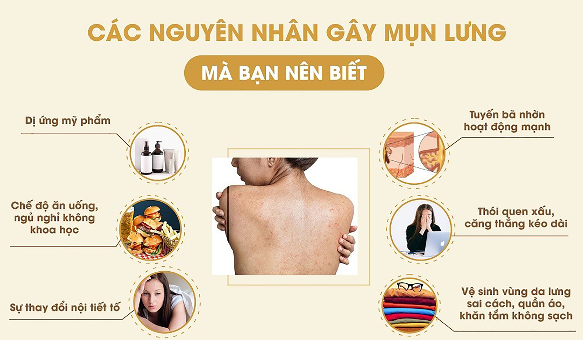 Mụn lưng là gì?