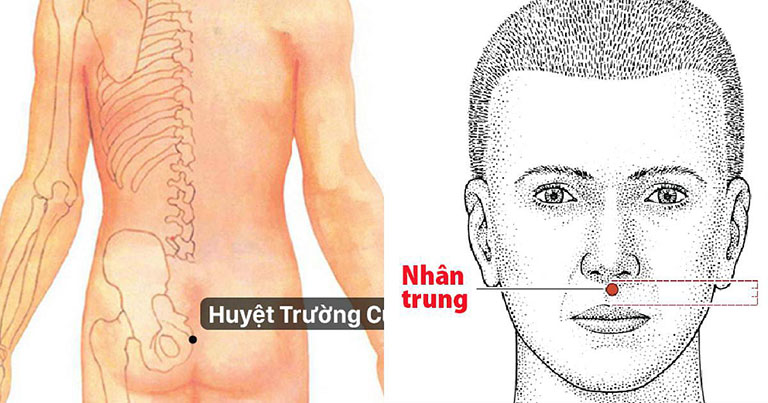 Triệu Chứng Thượng Mã Phong