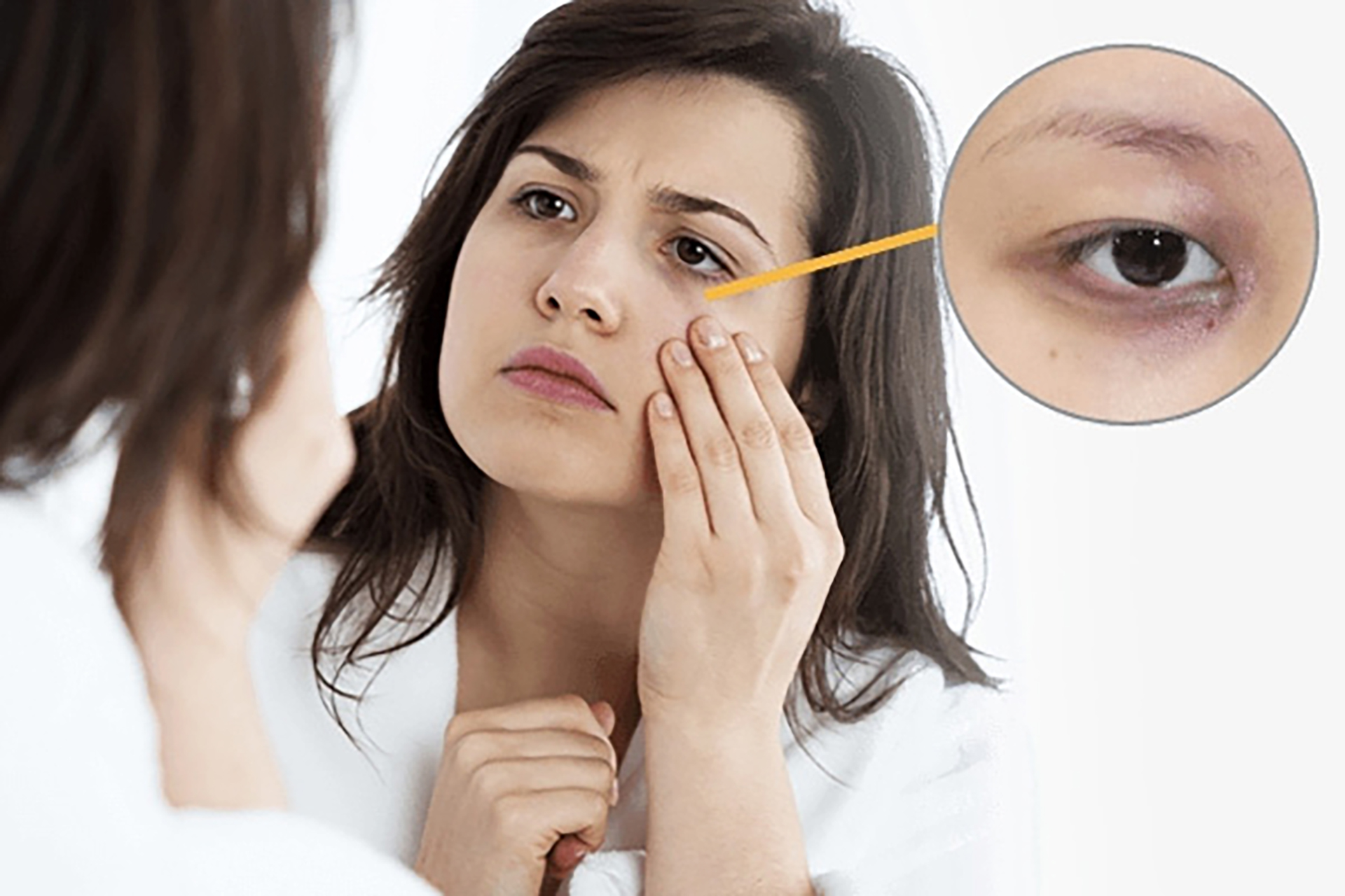 Làm sao để cải thiện thâm quầng mắt cho đôi mắt tươi trẻ va tinh anh?