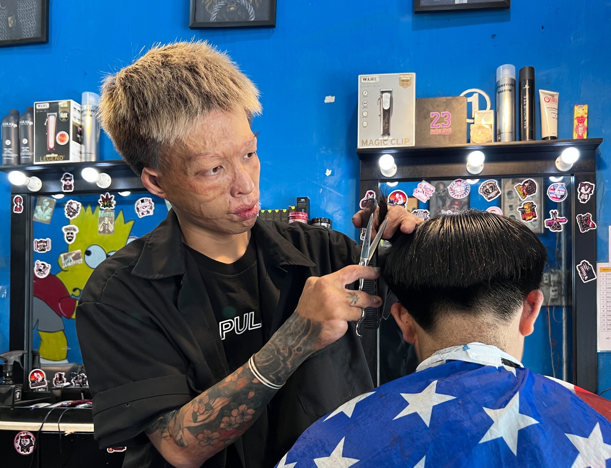 Chàng 'barber' bỏng 70% cơ thể: 'Phải kiếm tiền để nuôi mình' - Ảnh 1.