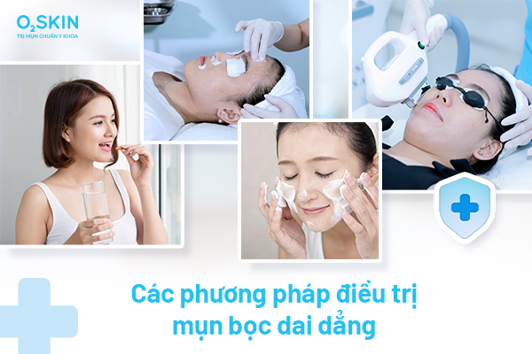 Mụn bọc dai dẳng, nguyên nhân và cách điều trị đúng - Ảnh 4.