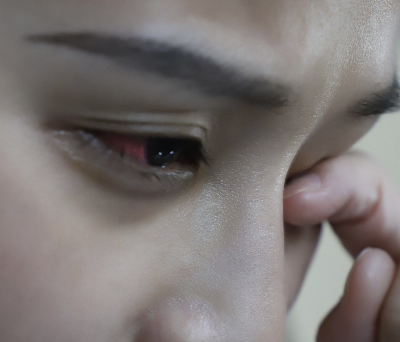 Tại sao khi bị đau mắt đỏ mắt lại có màu đỏ hoặc hồng  - Ảnh 1.