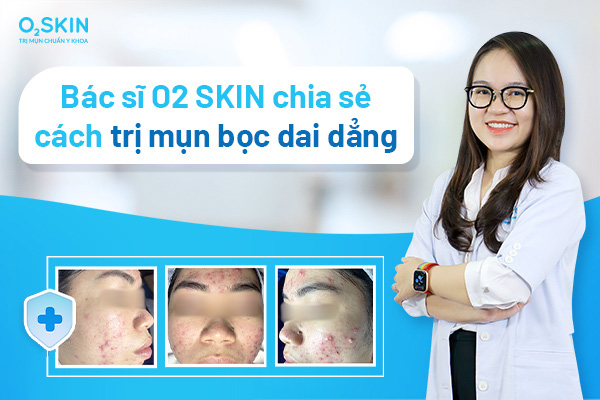 Mụn bọc dai dẳng, nguyên nhân và cách điều trị đúng - Ảnh 1.