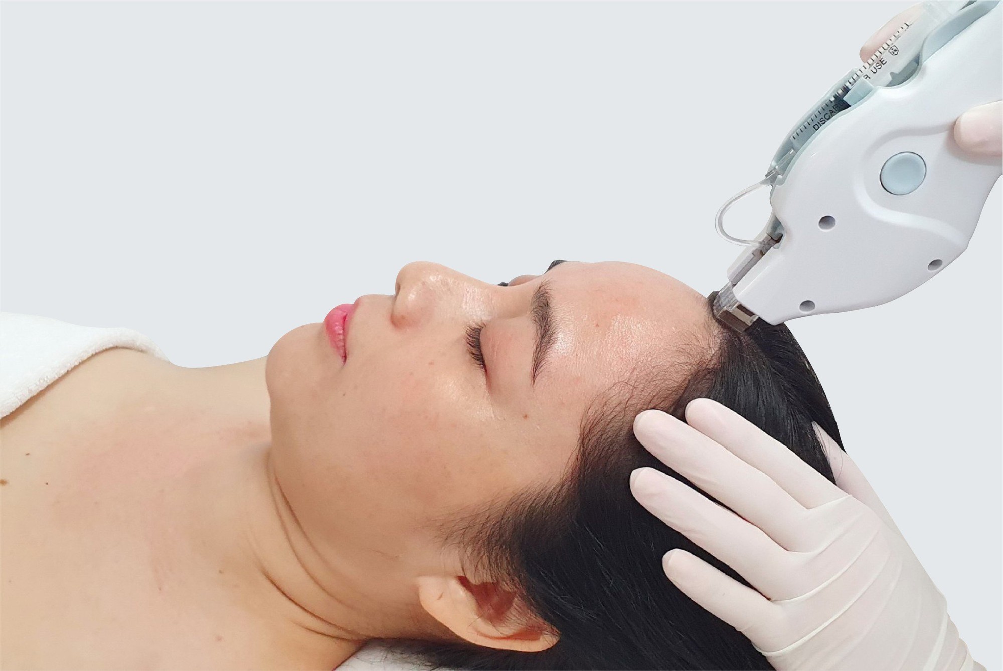 Cơn sốt làm đẹp với công nghệ meso không kim vẫn chưa hạ nhiệt