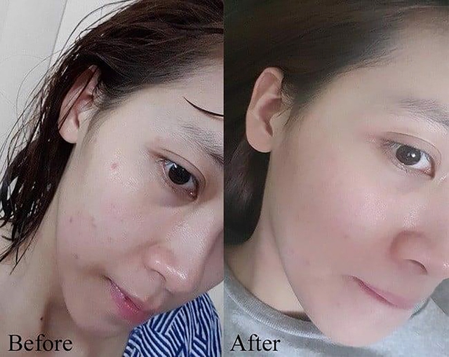 Top 10 serum trị mụn ẩn, mụn viêm, mụn trứng cá được tìm mua nhiều hiện nay- Ảnh 7.