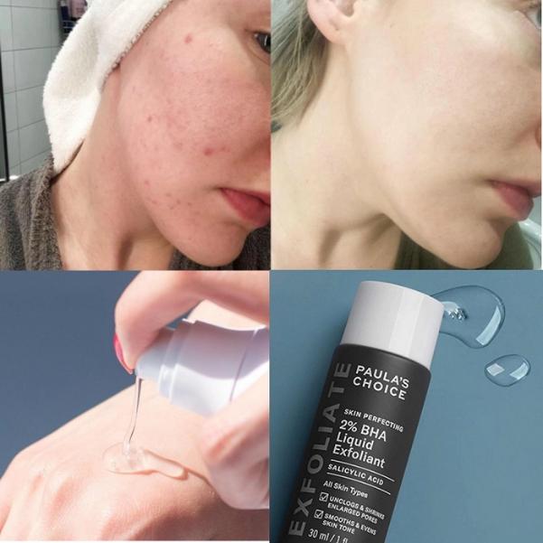 Top 10 serum trị mụn ẩn, mụn viêm, mụn trứng cá được tìm mua nhiều hiện nay- Ảnh 9.