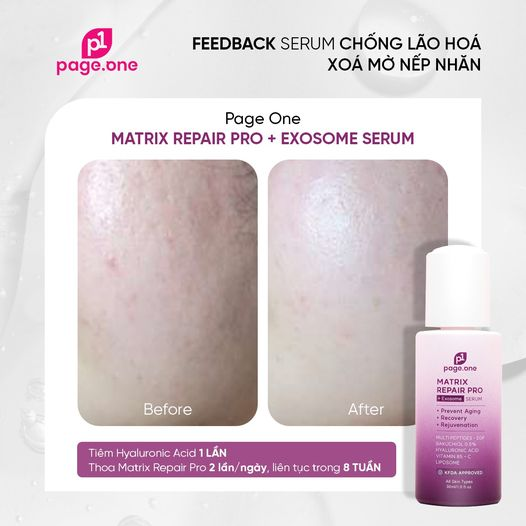 Hướng dẫn sử dụng serum chống lão hóa PageOne cho làn da căng trẻ sau 6 tuần