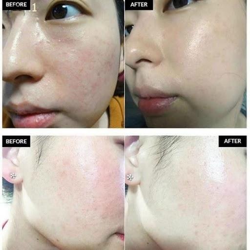 Top 3 kem dưỡng ẩm phục hồi mà mọi làn da treatment đều cần- Ảnh 3.