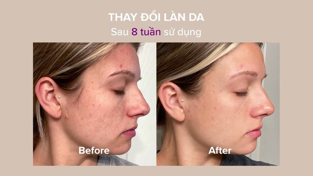 Tổng kết 5 Retinol không gây bong tróc có lượt bán cao hàng đầu năm 2024- Ảnh 2.