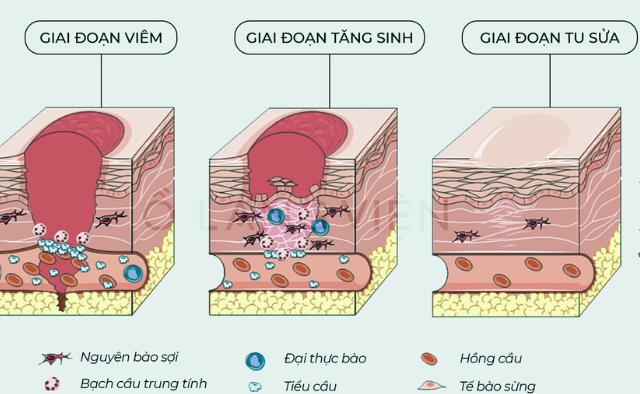 Giải pháp đơn giản giúp kết quả tạo hình thành bụng đẹp hơn- Ảnh 3.