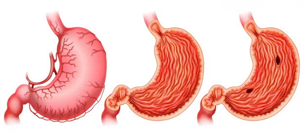 Bạn thuộc nhóm máu nào, hãy xem nó ảnh hưởng đến sức khỏe ra sao?- Ảnh 2.