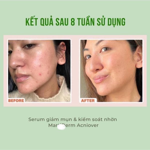 Top 10 serum Niacinamide đang được mua đi mua lại hàng ngàn lần trên Tiktok- Ảnh 7.