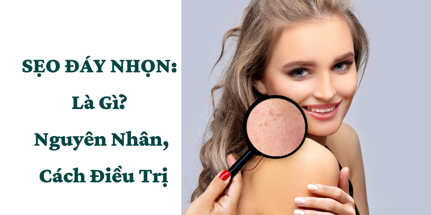 Sẹo đáy nhọn là gì? Top 5 cách điều trị sẹo đáy nhọn hiệu quả hiện nay- Ảnh 1.