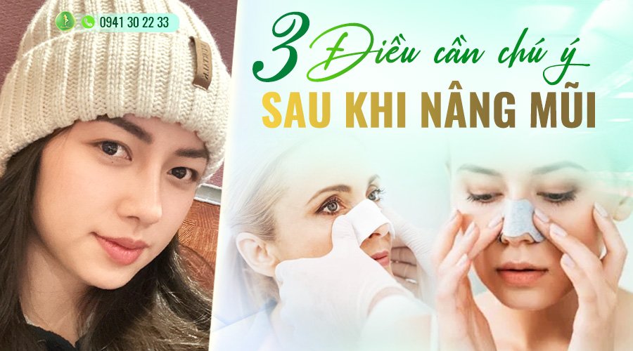 3 điều cần chú ý sau khi nâng mũi- Ảnh 1.