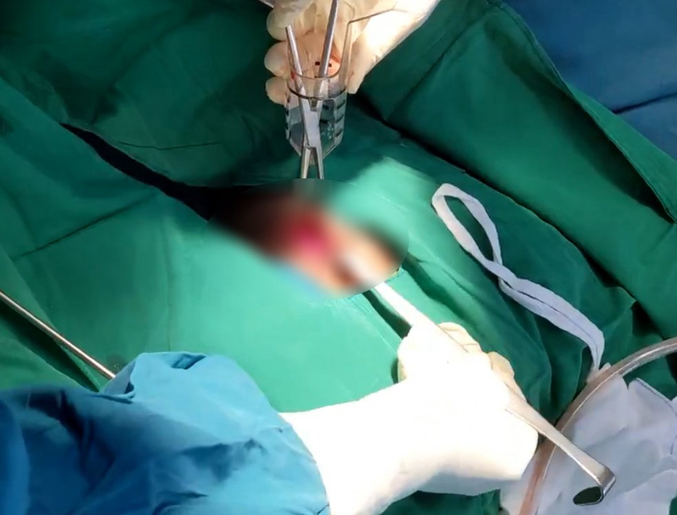 Nhập viện cấp cứu vì dương vật giả nằm trong hậu môn- Ảnh 1. Nhập viện cấp cứu vì dương vật giả nằm trong hậu môn- Ảnh 1.