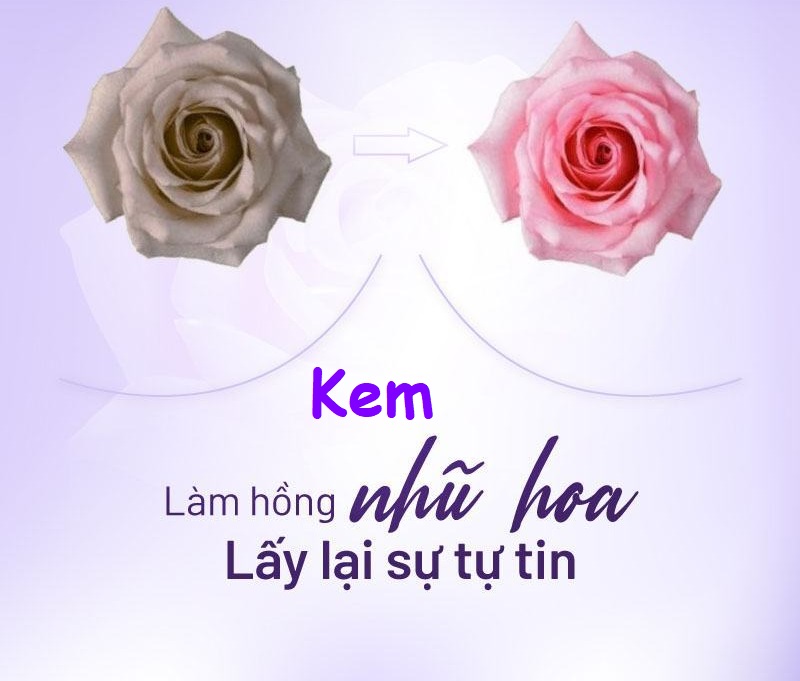 10. Kết Luận: Lựa Chọn Phương Pháp Phù Hợp