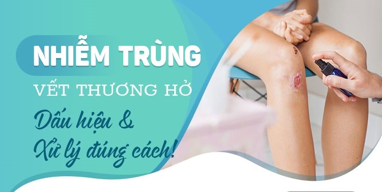 Nhiễm Trùng Có Nguy Hiểm Không? Khám Phá Những Điều Cần Biết Để Bảo Vệ Sức Khỏe