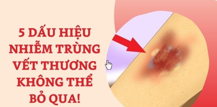 6. Biện pháp phòng ngừa nhiễm trùng vết thương