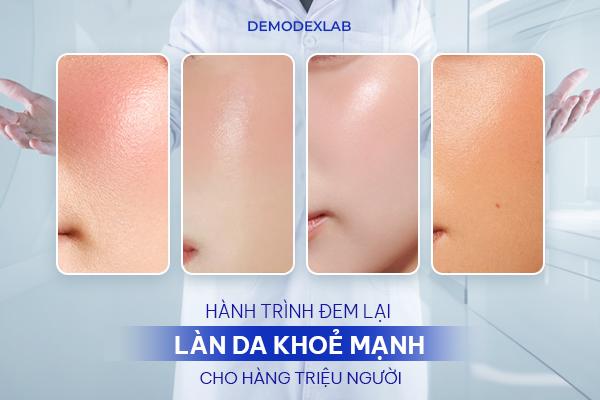 Demodexlab - Hành trình đem lại làn da khỏe mạnh cho hàng triệu người- Ảnh 1.