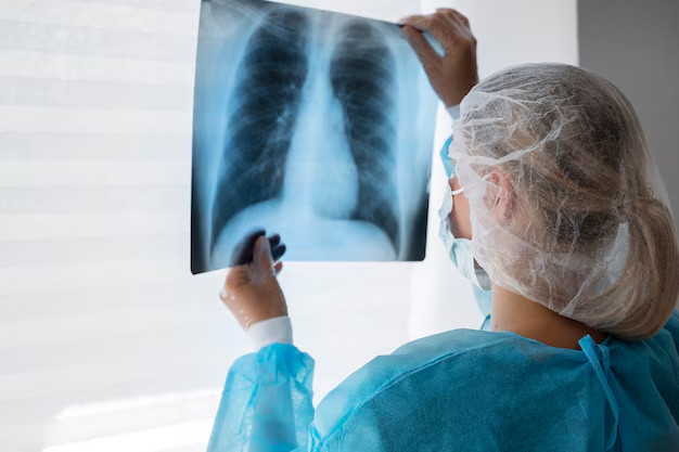 Kết quả chụp X-quang ngực và toàn bộ cơ thể đã phát hiện ra thủ phạm là ung thư phổi