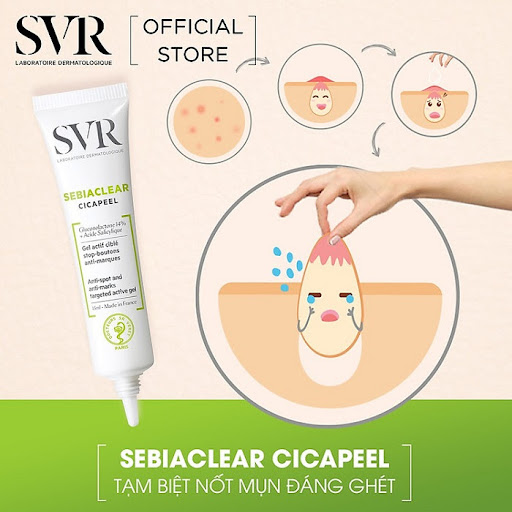 Ai nên dùng Gel trị mụn chuyên biệt SVR Sebiaclear Cicapeel?