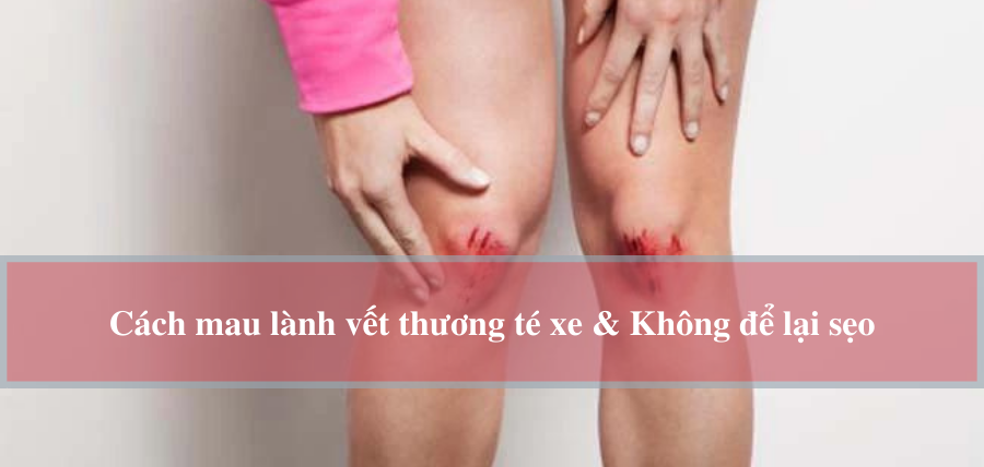 Bị té xe trầy chân nên làm gì để vết thương mau lành và ngừa sẹo xấu?- Ảnh 6.