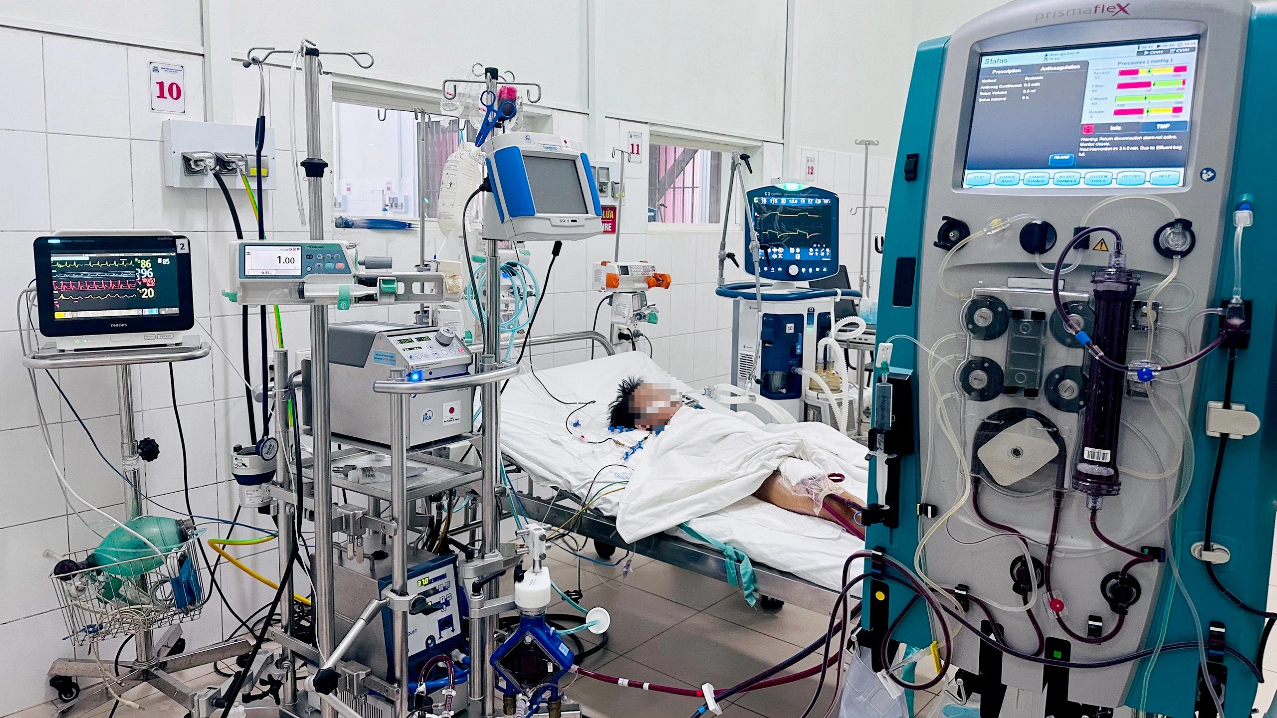 'Nghẹt thở' cứu sống bệnh nhi sốc tim nặng tại Bệnh viện T.Ư Huế- Ảnh 1. 'Nghẹt thở' cứu sống bệnh nhi sốc tim nặng tại Bệnh viện T.Ư Huế- Ảnh 1.
