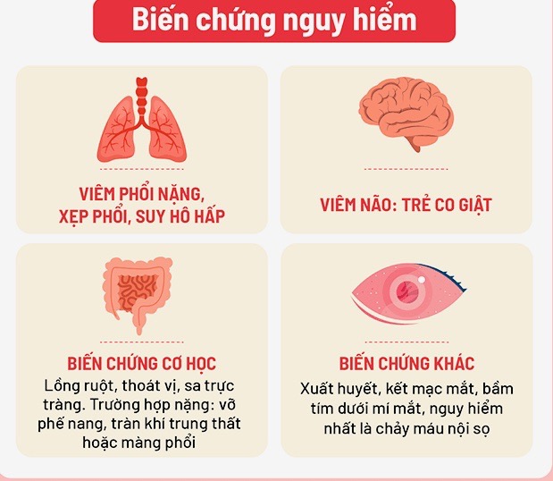 Ca bệnh ho gà tại Hà Nội tăng cao- Ảnh 1.