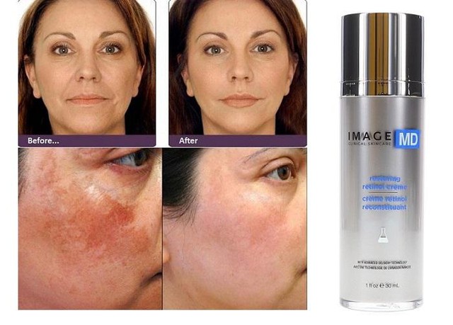 Review kem trị nám Image Skincare có tốt không và top sản phẩm bán chạy- Ảnh 6. Review kem trị nám Image Skincare có tốt không và top sản phẩm bán chạy- Ảnh 6.