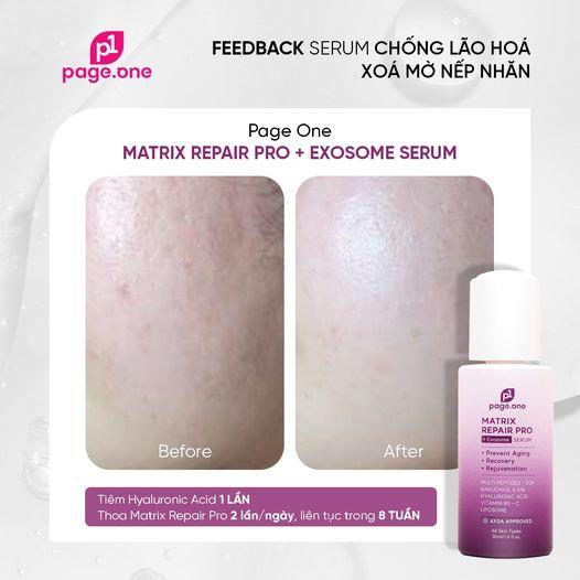 Review serum chống lão hóa Page One Matrix Repair Pro + Exosome Serum có hiệu quả không?- Ảnh 1.