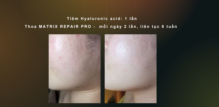 Review serum chống lão hóa Page One Matrix Repair Pro + Exosome Serum có hiệu quả không?- Ảnh 7.