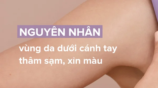 Bật mí cách trị thâm nách hồng hào tự nhiên ngay tại nhà- Ảnh 2.