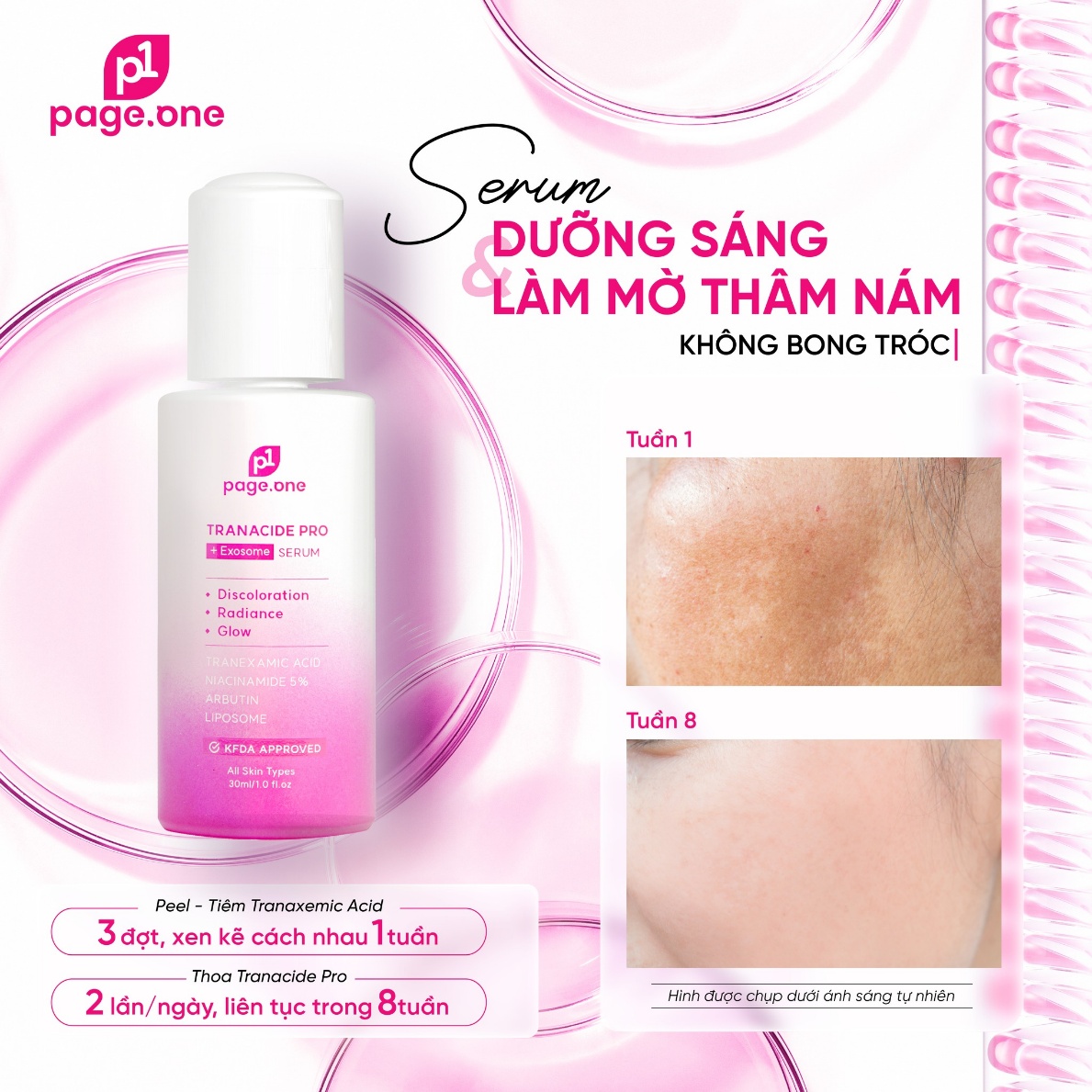 Top 10 serum trị nám sạm, tàn nhang hiệu quả hàng đầu hiện nay- Ảnh 3.