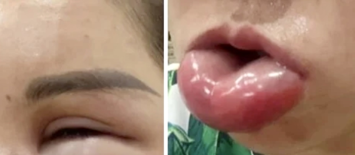 Nhiều cơ sở thẩm mỹ mạo danh bệnh viện, mập mờ chuyên môn- Ảnh 1. Nhiều cơ sở thẩm mỹ mạo danh bệnh viện, mập mờ chuyên môn- Ảnh 1.